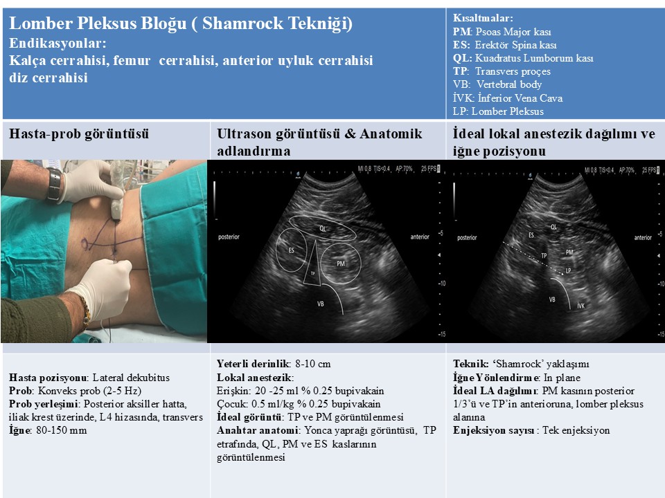 Lumbar Pleksus Bloğu