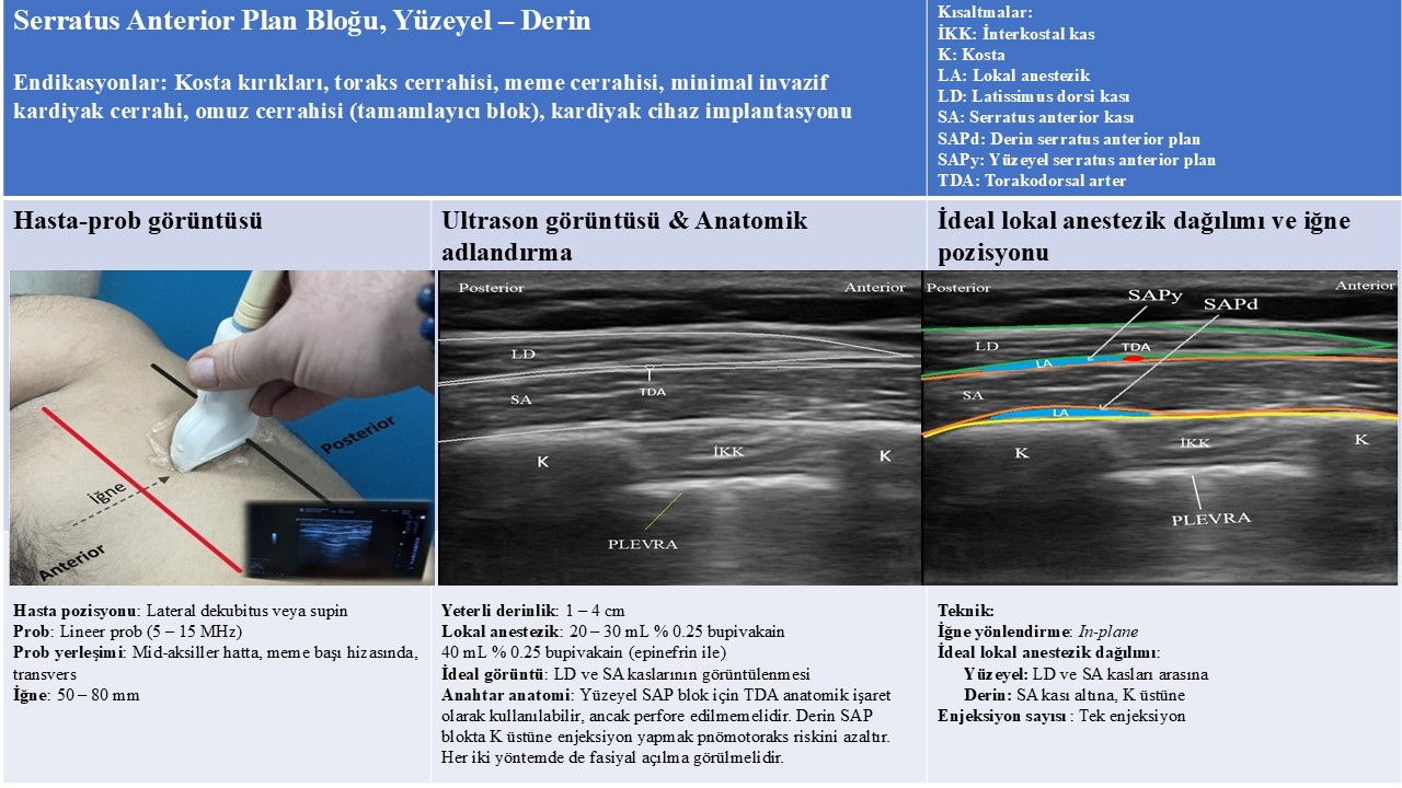 Serratus Anterior Plan Bloğu
